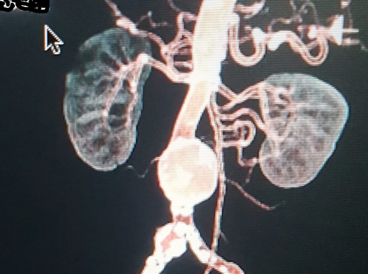 aort-ve-damar-hastaliklari